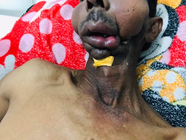ކެންސަރުގެ ފަރުވާއަށް ހުސައިން އެދެނީ ދީލަތި އެހީއަކަށް